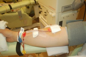 成分献血で本採血中の右腕